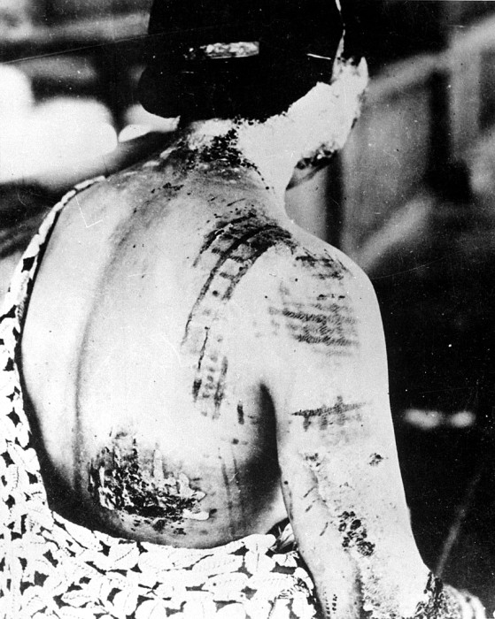 Hibakusha: 
denominazione di reduce bomba nucleare su Hiroshima, 1945
da Wikipedia: 
Hibakusha (被爆者) è il termine giapponese 
per designare i sopravvissuti al bombardamento atomico di Hiroshima e Nagasaki. 
Letteralmente il termine significa “coloro che sono stati colpiti dal bombardamento” 
ed è composto da tre ideogrammi: ( hi ) riceve/subire, ( baku) esplosione, 
( Sha) persona. La scelta di questo termine per indicare coloro 
che sono scampati al bombardamento ...